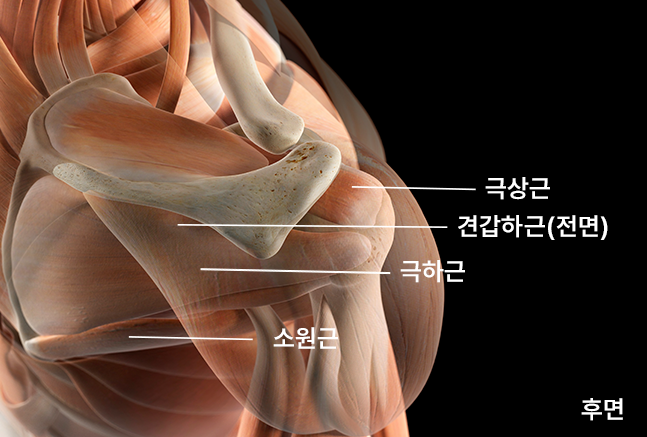 회전근개파열